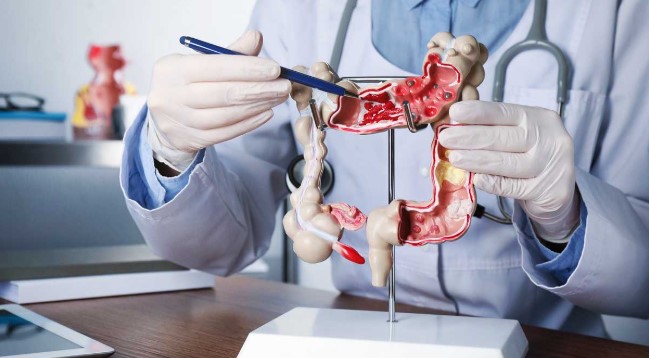 Destacan el valor del testeo en un tumor prevenible y&nbsp;curable